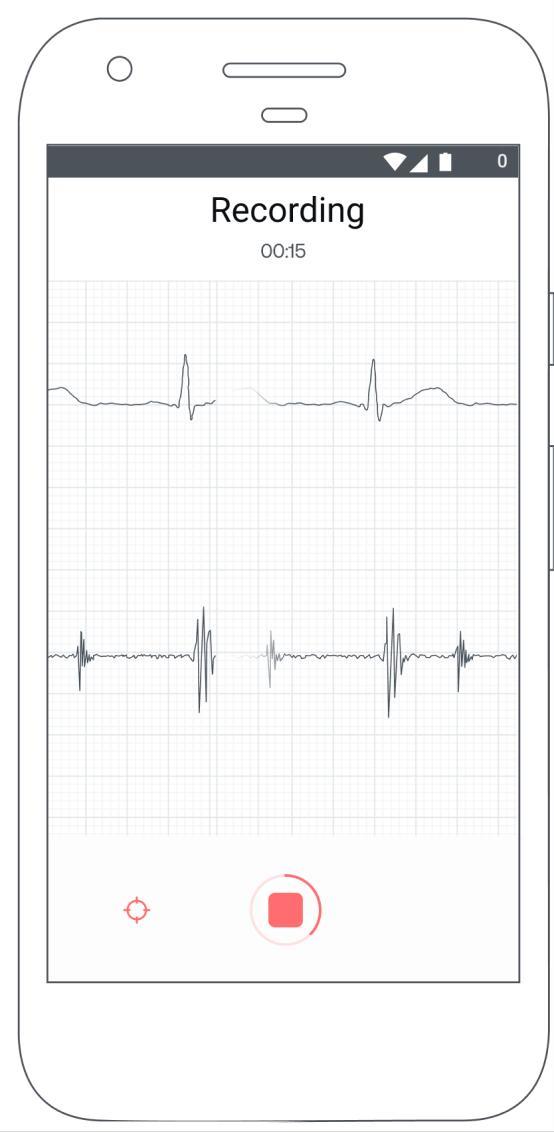 Eko: Digital Stethoscope + ECG_playmods.net