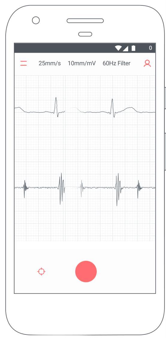 Eko: Digital Stethoscope + ECG_playmods.net