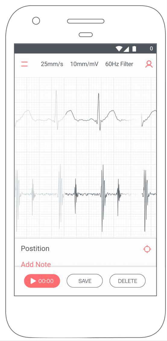 Eko: Digital Stethoscope + ECG_playmods.net